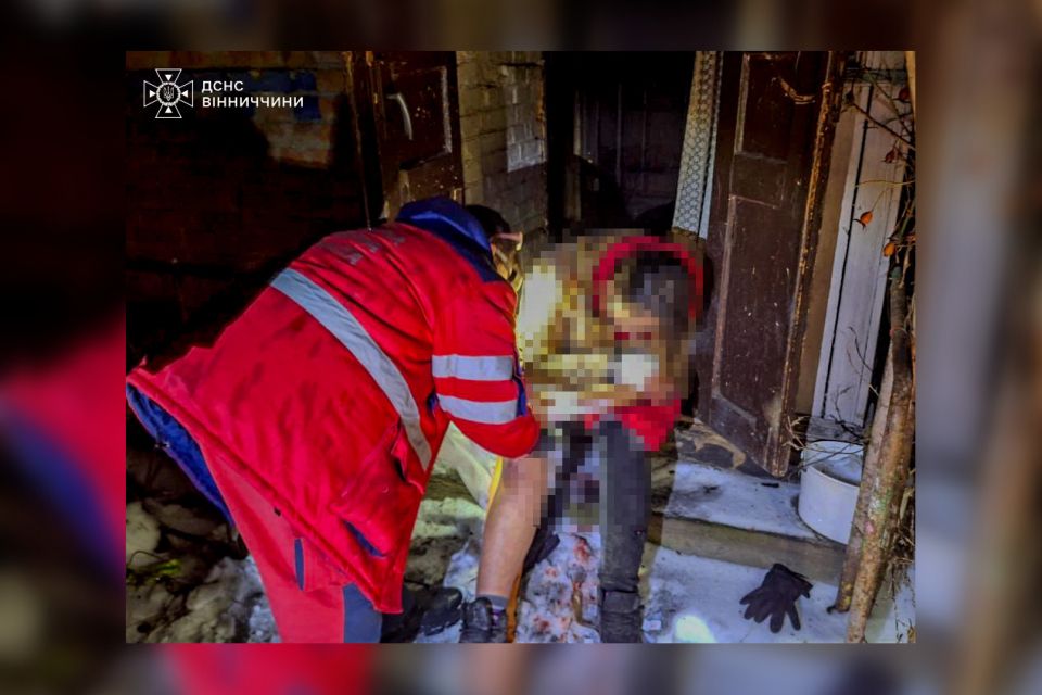 У Кордишівці горів будинок, а у Махаринцях вибухнув котел. Постраждала жінка