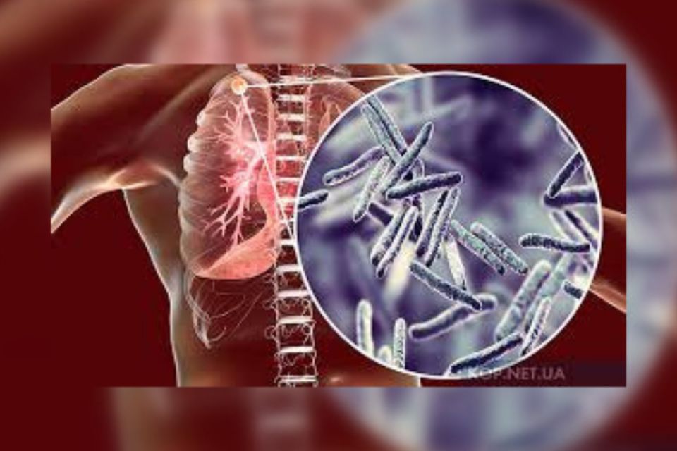 Успіх боротьби з туберкульозом залежить від нас самих