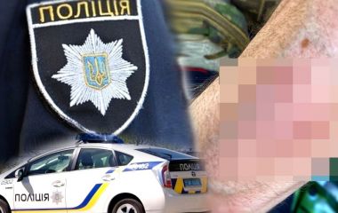 «Били і чоловіків, і жінку. А в машині кричали діти». Що кажуть у поліції про бійку у Йосипівці?