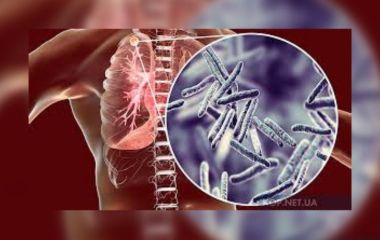 Успіх боротьби з туберкульозом залежить від нас самих