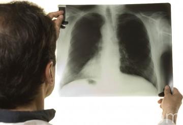 Причина розлучення — сухоти у жінки на сайті 20minut.ua Причина розлучення — сухоти у жінки, фото №1 на сайті 20minut.ua